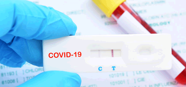 Com quase mil casos registrados Covid-19 segue em alta e registra uma morte pela doença