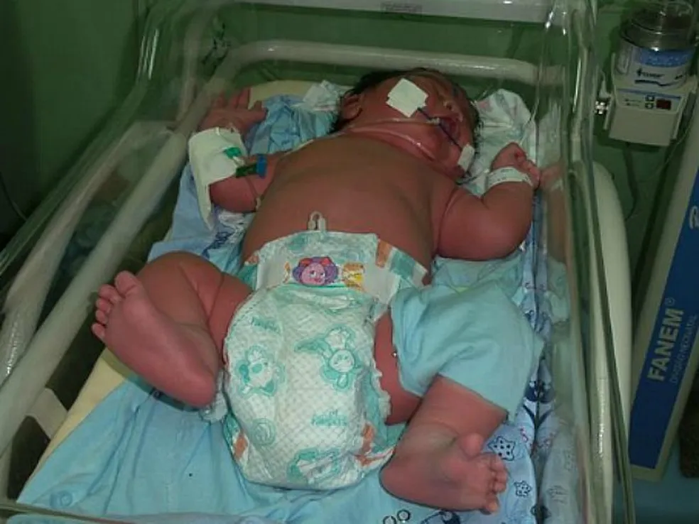 ‘Bebê Gigante’ nasce com mais de 7 kg, no interior do AM