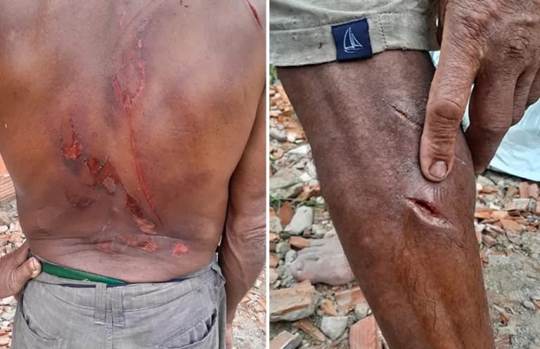 Criminosos que torturaram homem com motoserra em Feijó, são presos pela Polícia Civil